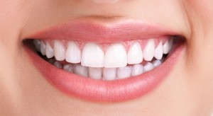 whitening - bleaching treatment ,before and after ,woman teeth and smile, close up, isolated on white